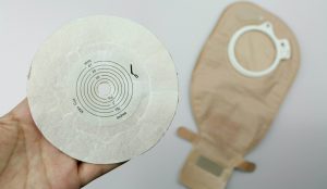 stoma bag